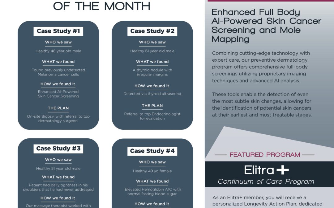 Elitra Pulse: August 2025